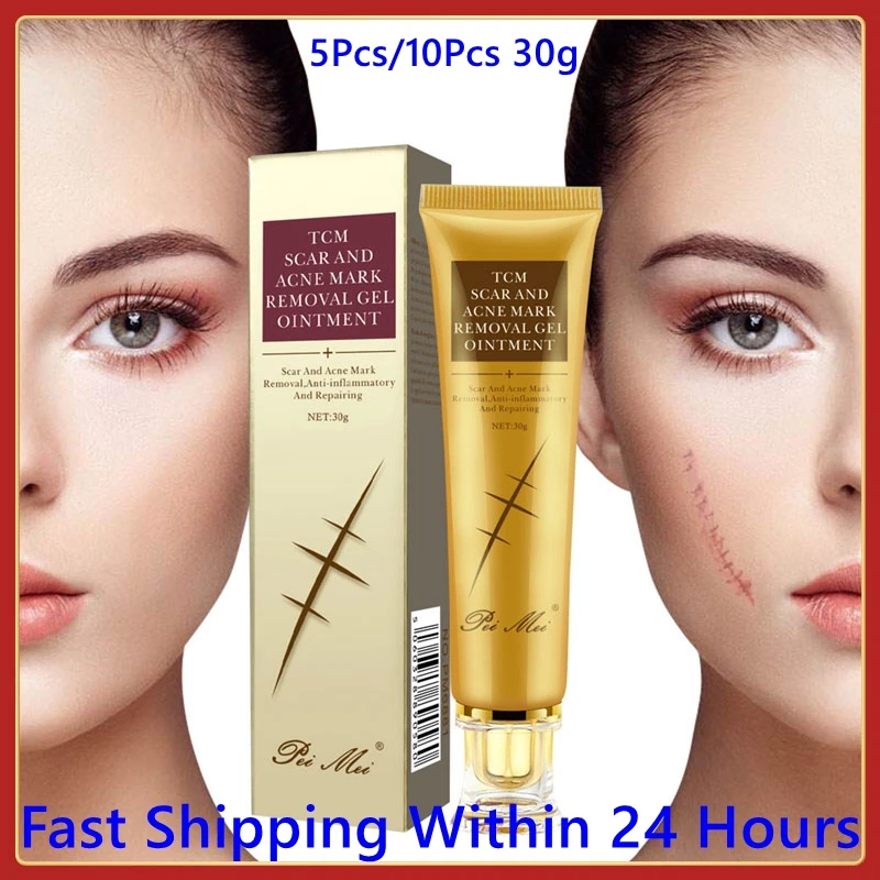 

10pcs Acne Scar Removal Cream Skin Repair Face Cream Acne Spots Acne Treatment Blackhead Whitening Cream Stretch Marks 30g