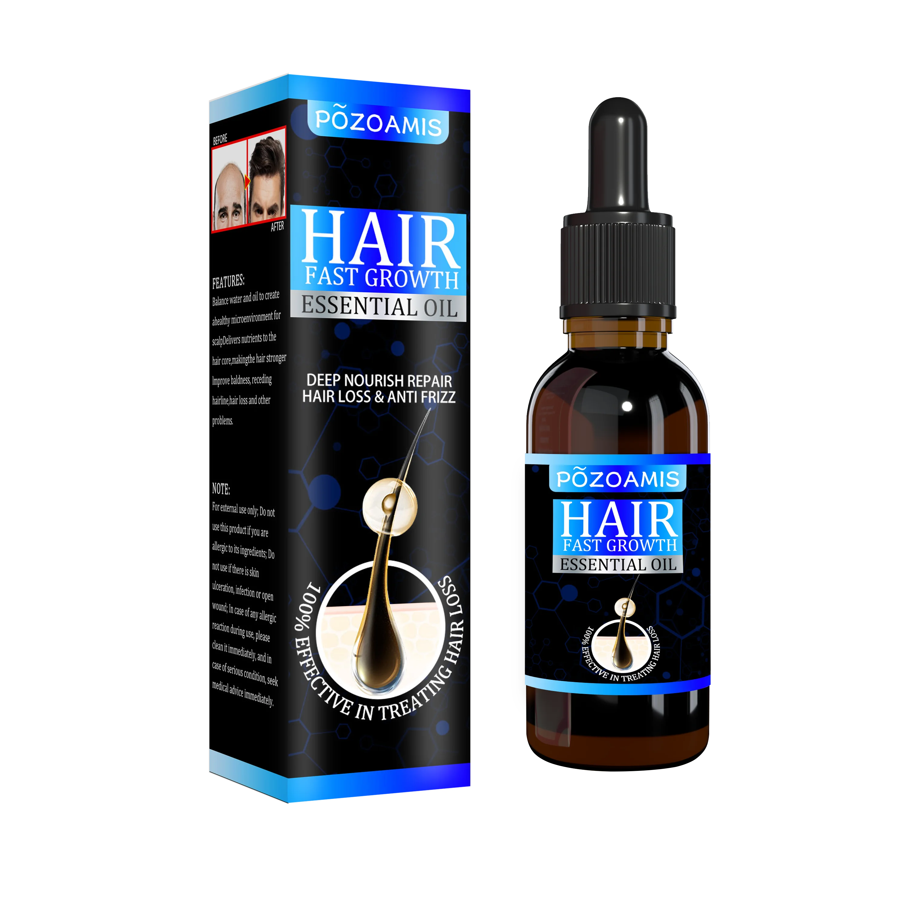 

Масло для роста волос, эффективное восстановление облысения и выпадения волос после родов