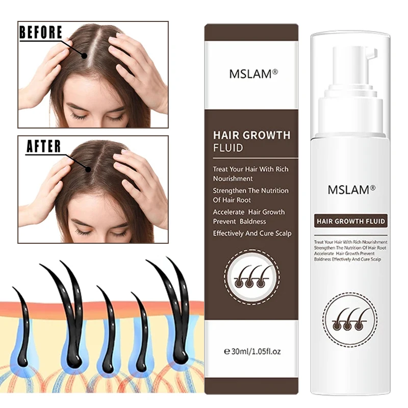 

Hair Growth Fluid Prevent Hair Loss Nourishing Repair Damaged Fast Regrowth Oil Control Ginseng Licorice Serum Scalp Treatment