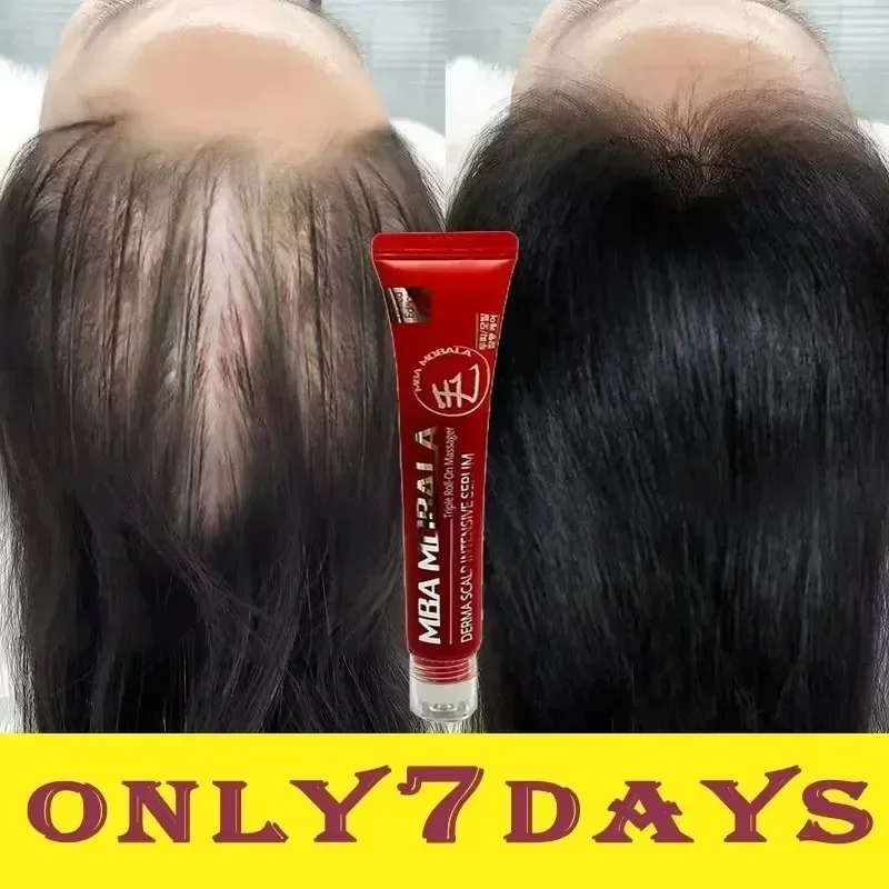 Сыворотка для быстрого роста волос восстановление облысения наследственный