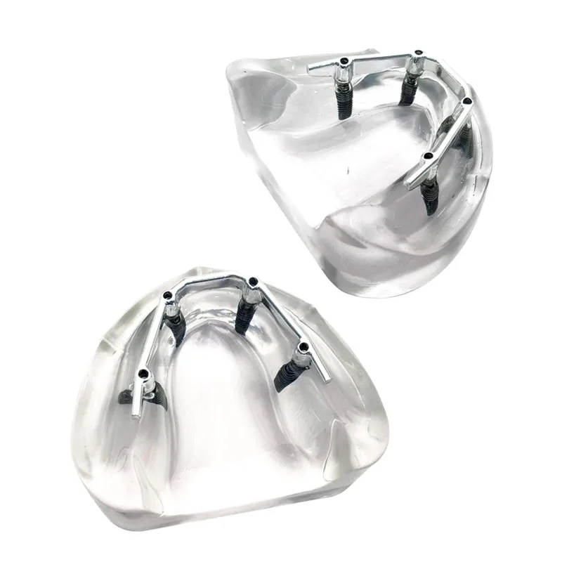 Зубной имплантат модель зубов 4 имплантаты зубной протез серебряный стержень