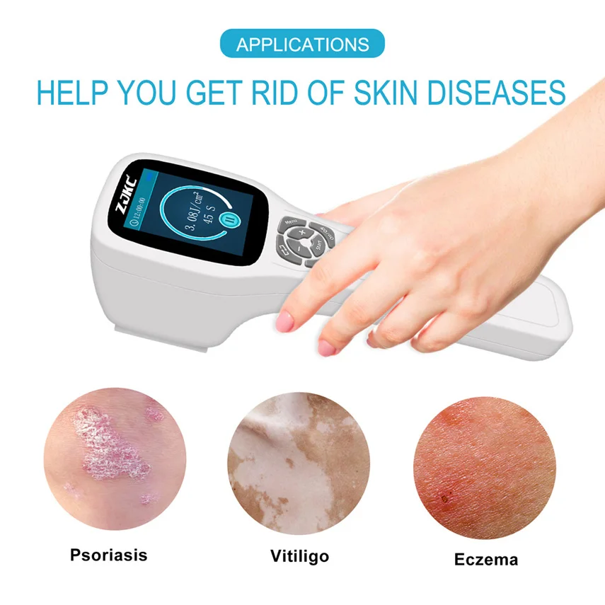 Эксимер ZJKC нм Uvb фототерапия при псориазе Vitiligo Eczema устройство для лечения кожных