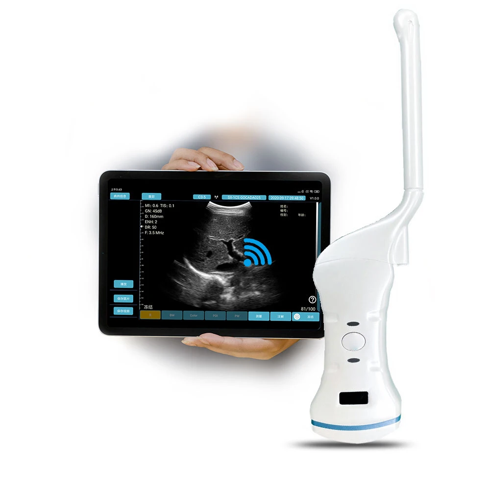 Беспроводной цветной доплеровский ультразвуковой датчик 2 в 1 беспроводной