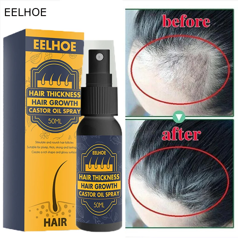 Castor Oil Hair Growth Spray Fast Grow Anti Hair Loss Products Beard Prevent Baldness Thinning Scalp Treatment Serum Men Women