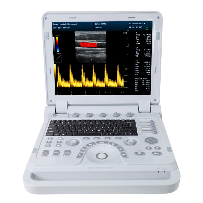

Video technical support CONTEC CMS1700B Portable B-Ultrasound Diagnostic Scanner
