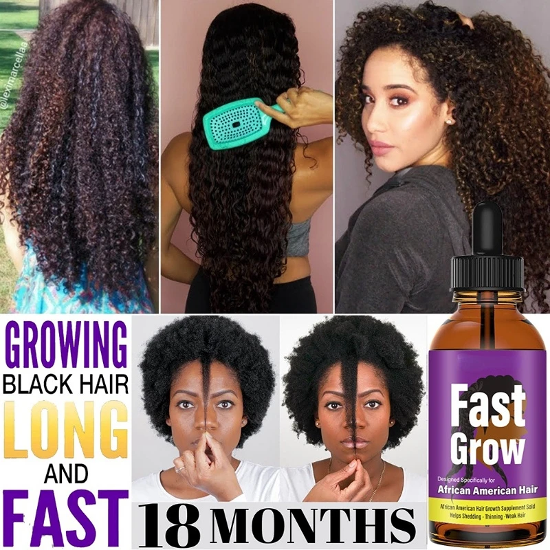 

Herbal Hair Growth Essential Oil Natural Anti Hair Loss Products Fast Grow Prevent Baldness Treatment Germinal Liquid Men Women