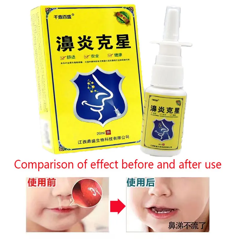 

Травяной спрей для ринита, средство для ухода за хроническим ринитом, лечение синусита, китайский традиционный медицинский спрей