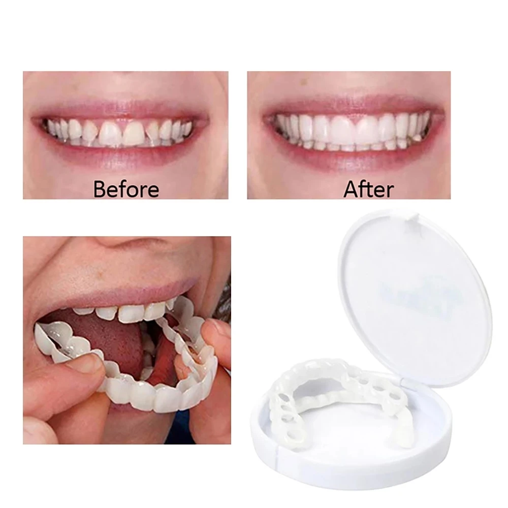 

The Upper and Lower Veneer Teeth Whitening Denture Whitening Kit Is Currently Only Available for Wholesale and Direct Sales