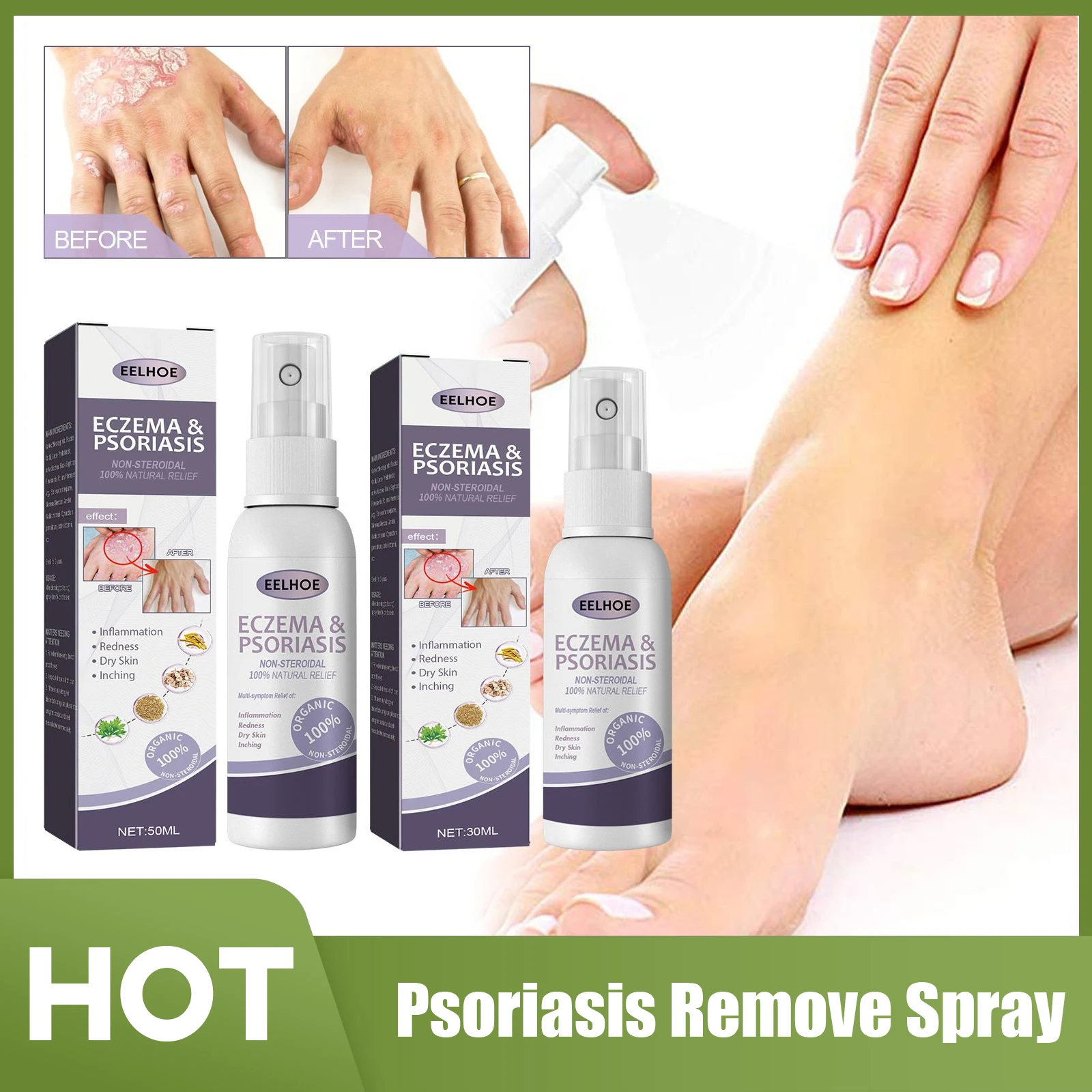 

Psoriasis Remove Spray Psoriasis Eczema Treatment Inhibit Dermatitis Fungus Instantly Relieve Itching Soothing Repairing Skin