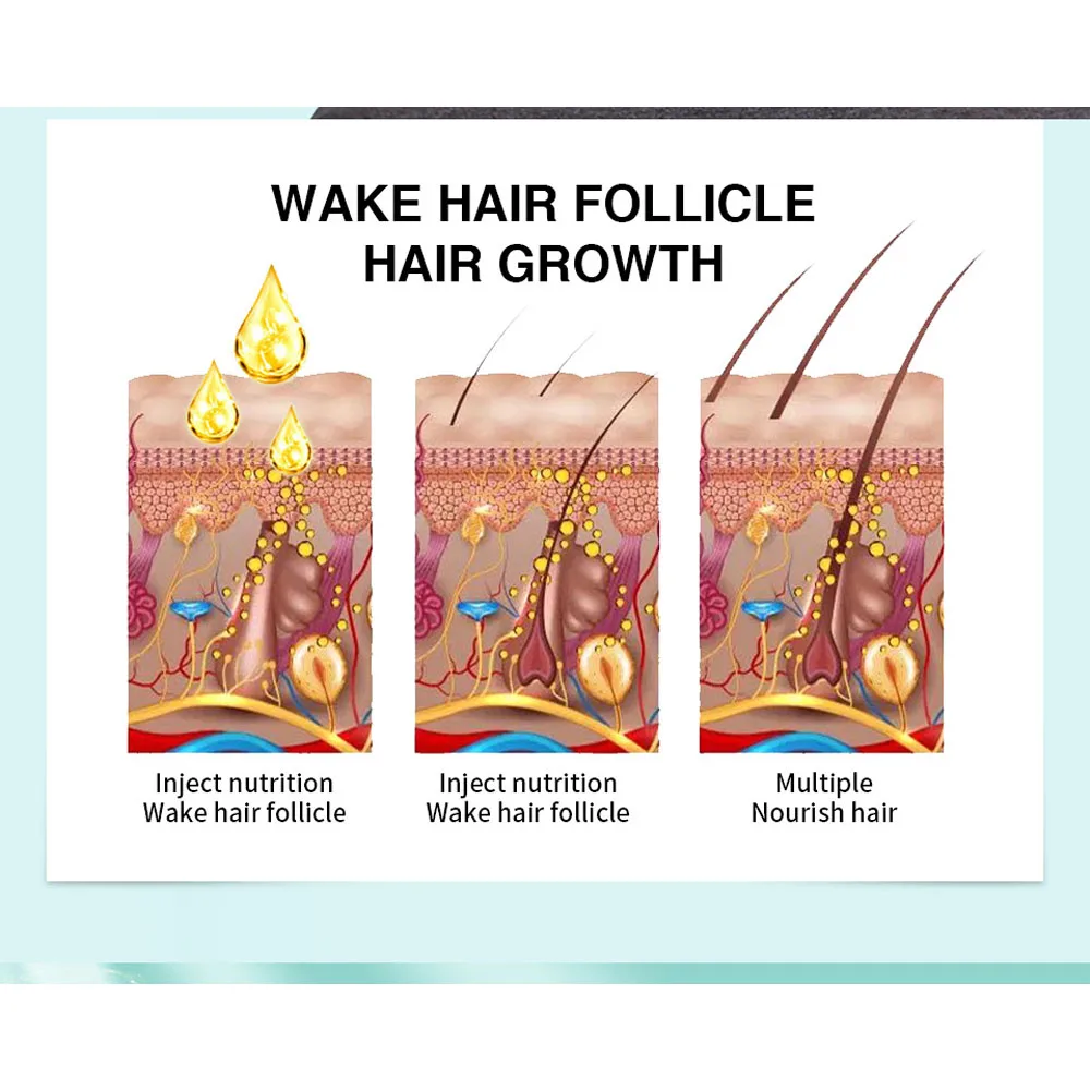 Имбирные продукты для роста волос против выпадения имбирное масло