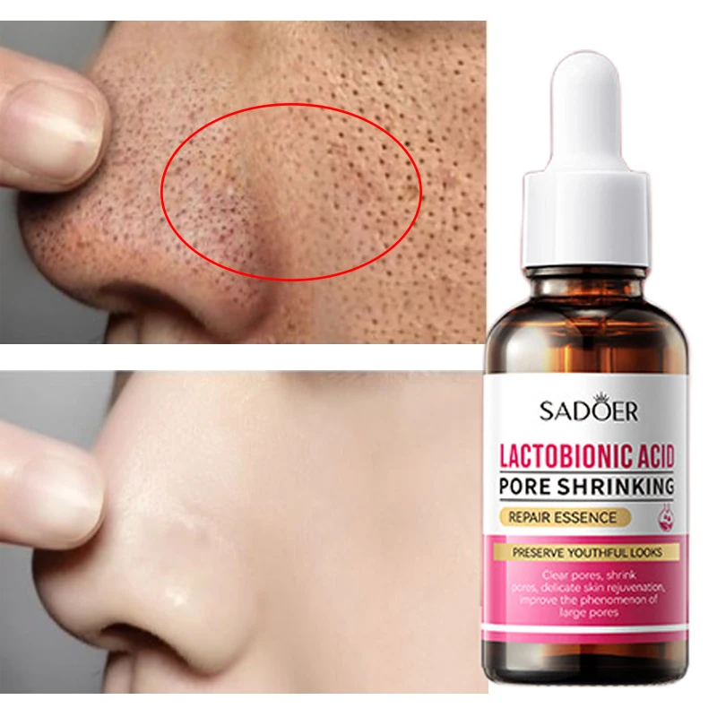 

Lactic acid Pore Shrinking Repair Essence Acne Removing Blackhead Whitening Moisturize Serum Smooth Skin Care Bulky Wholesale