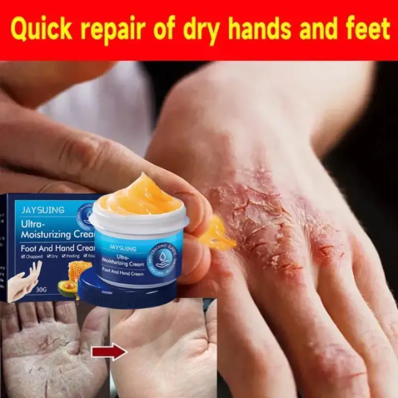 

30g Anti-Drying Crack Foot Hand Cream Heel Cracked Repair Hand Feet Mask Moisturizing Whiten Dead Skin Removal Smooth Skin Care