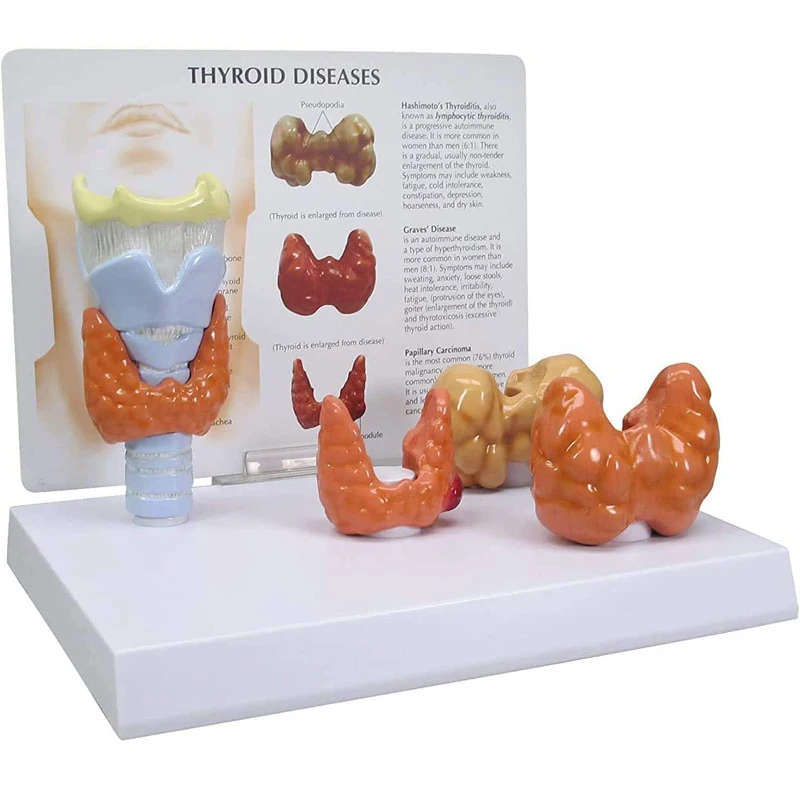 

Анатомическая модель щитовидной железы