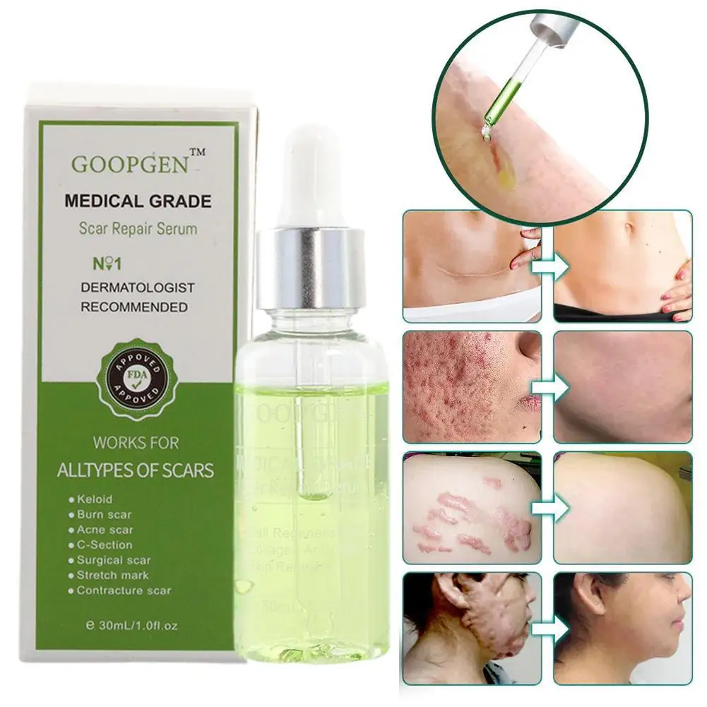 

30ml Scar Removal Serum Remove Acne Spots Treatment Stretch Marks Burn Scar Repair Cream Smoothing Whitening Skin Care Beauty