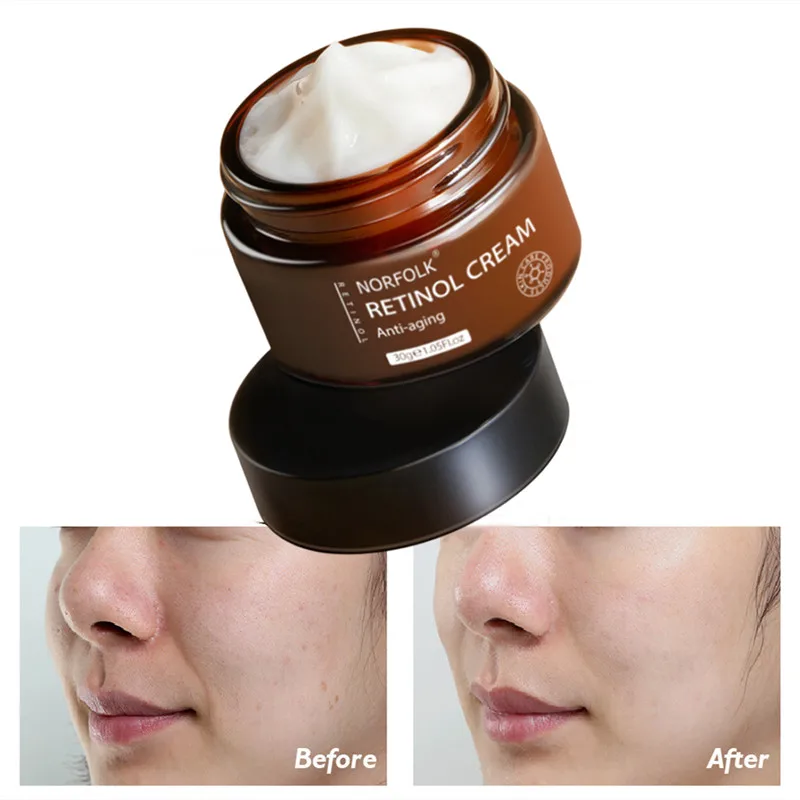 

Увлажняющий антивозрастной крем для лица, 30 г