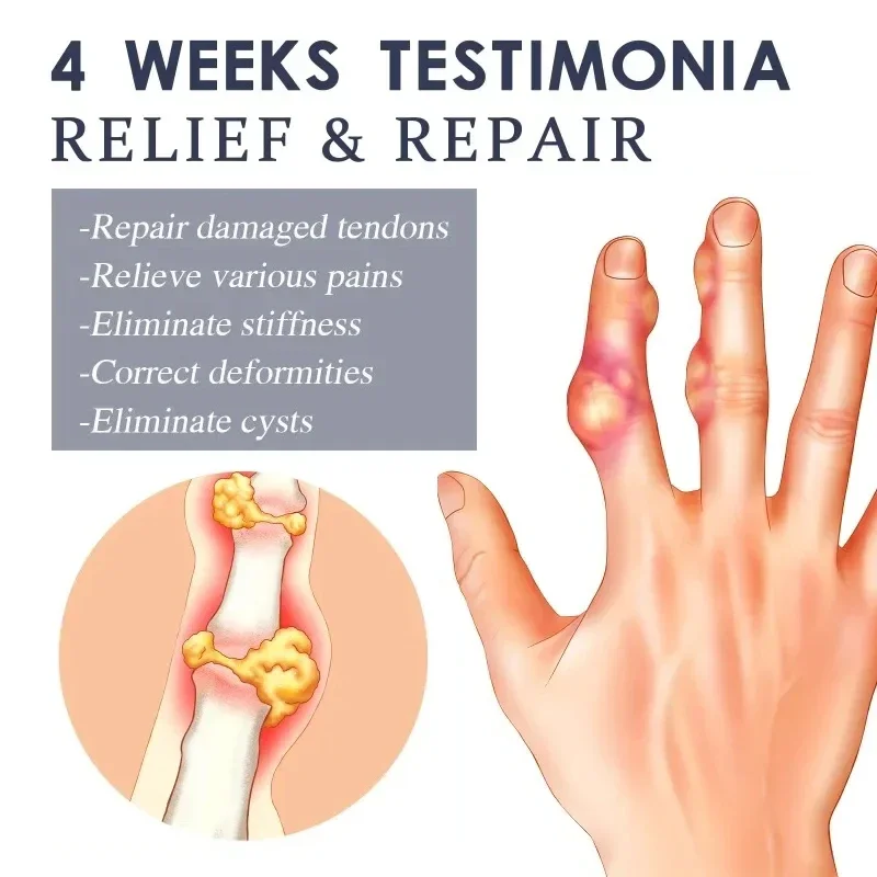 Пластырь для лечения подагры корректор большого пальца суставов артрита боли в