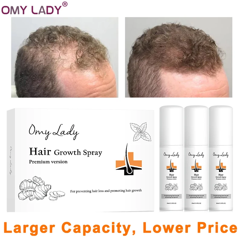

OMY LADY Hair Growth Spray Anti Hair Loss Products Natural With No Side Effects Hair Growth Essential Oil Liquid 180ml