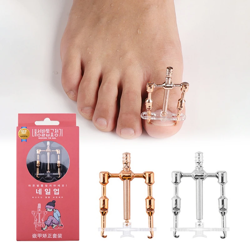 

Endogenous Nail Corrector Shaping Toenail Shape Foot Pedicure Care Tool