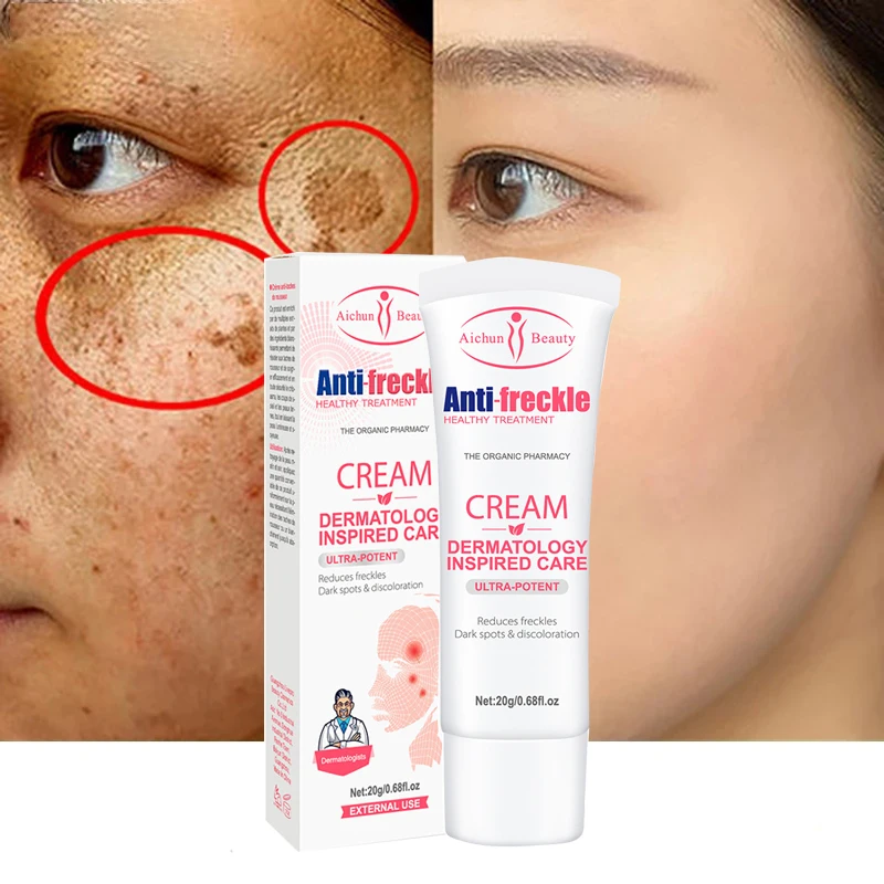 

Whitening Freckle Cream Remove Dark Spots Melanin Melasma Brighten Face Cream Pigmentation Anti-Aging Skin Care Cosmetics 20ML