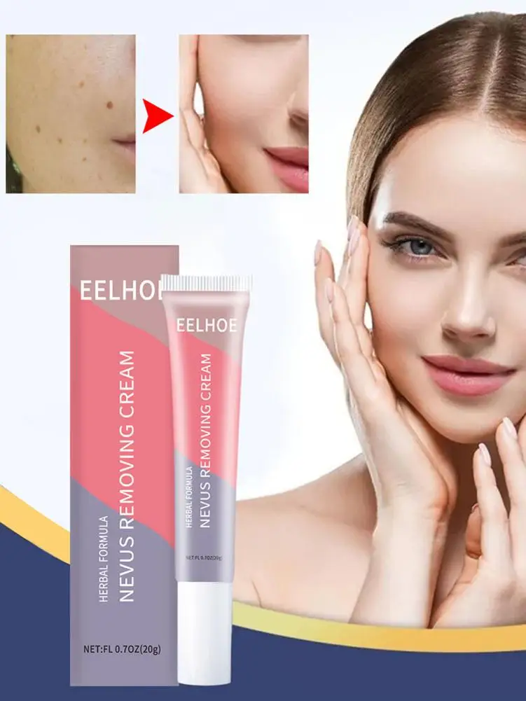 

Wart Remover Flat Wart Cream No Scars Left Easy To Use Plaster Warts SkinTag Remover Ointment Wart Treatment Cream