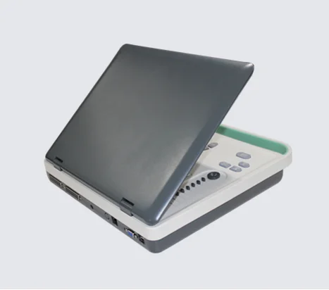 

Best Portable High End Sonoscape Scanning Ultrasound Machine