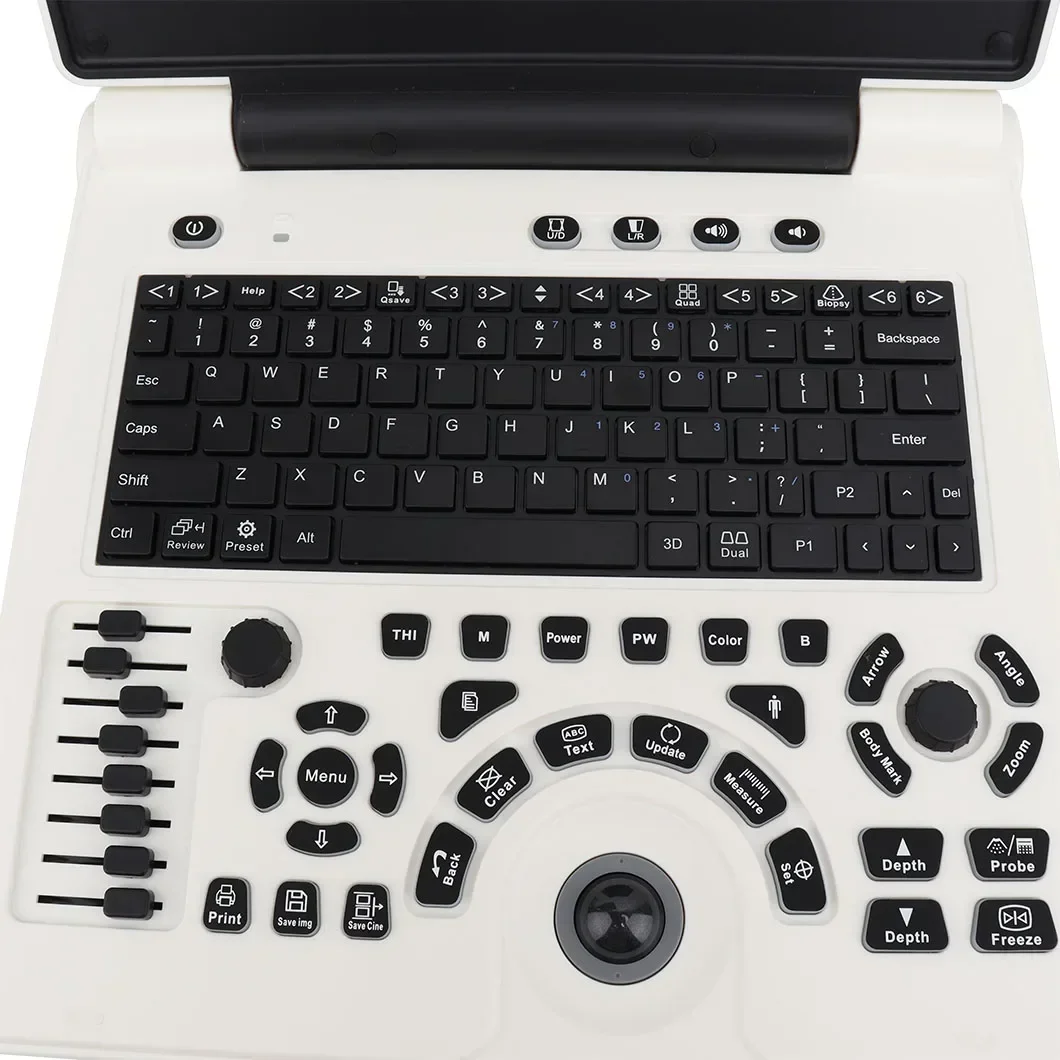 Kliniek Ziekenhuis Ob/Gyn Ноутбук Draagbare Ультразвуковая система Prijs Van машина