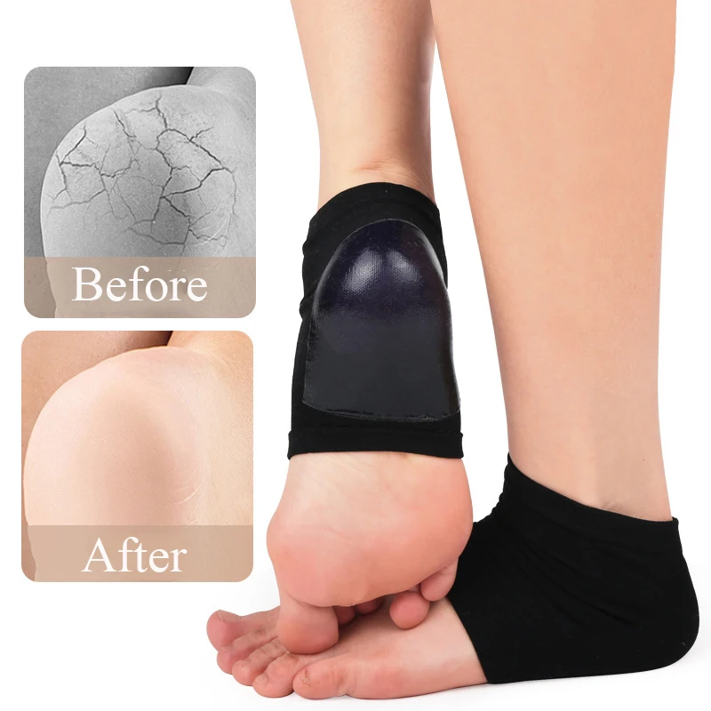 Рисунок 4 - 1 пара, средство для ухода за 