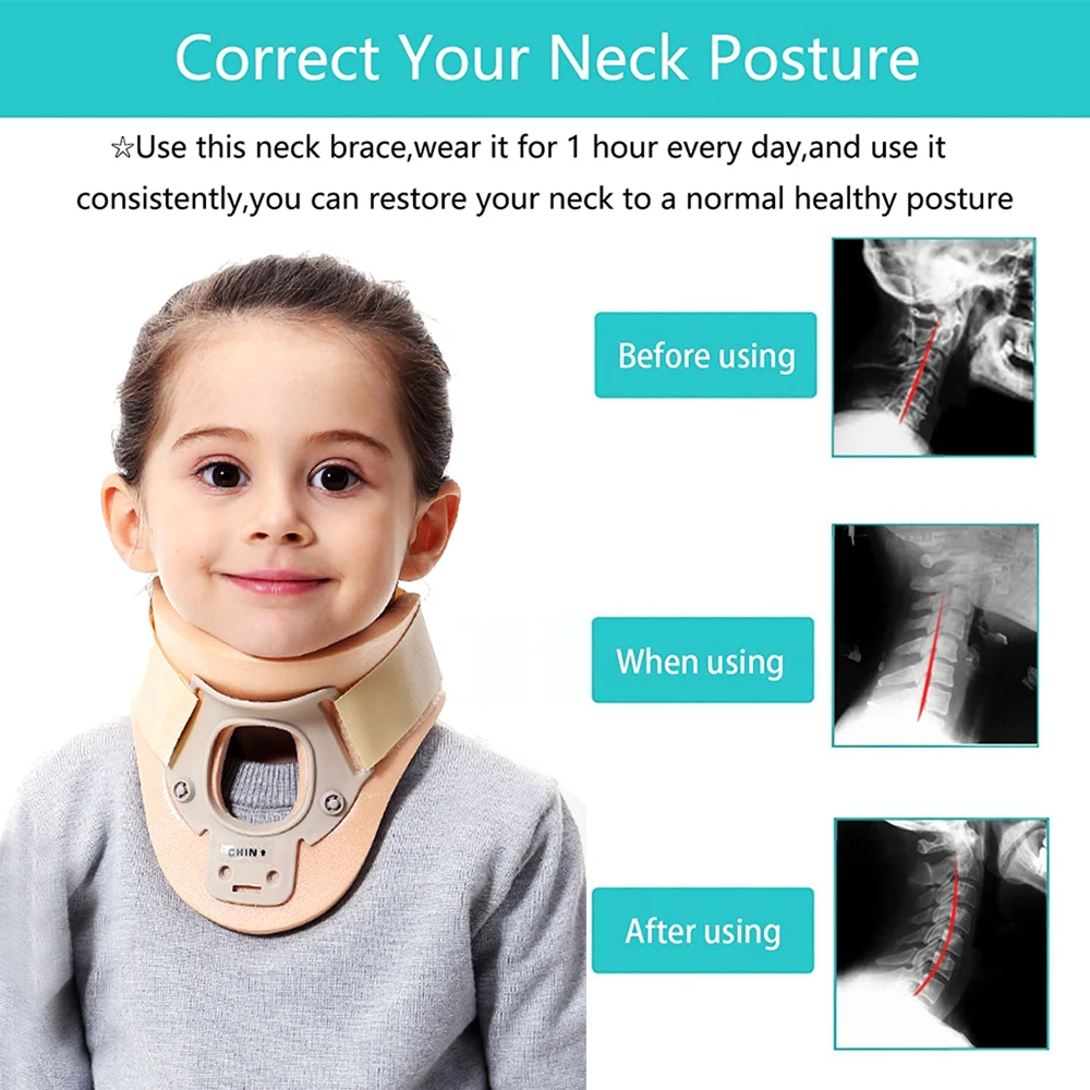 Thickened Baby Child Kids Cervical Brace Correct Posture Neck Collar Torticollis Collar Fixed Crooked Neck images - 6