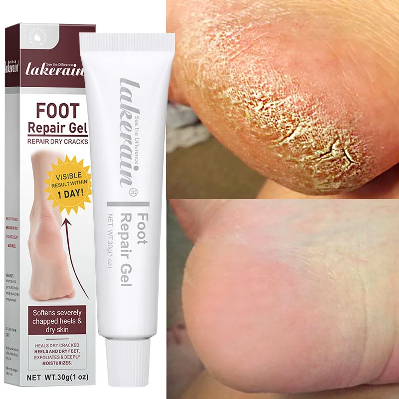 

Anti-Drying Crack Hand Foot Care Cream Heel Cracked Repair Products Remove Dead Skin Relieve Itching Moisturizing Nourish Care