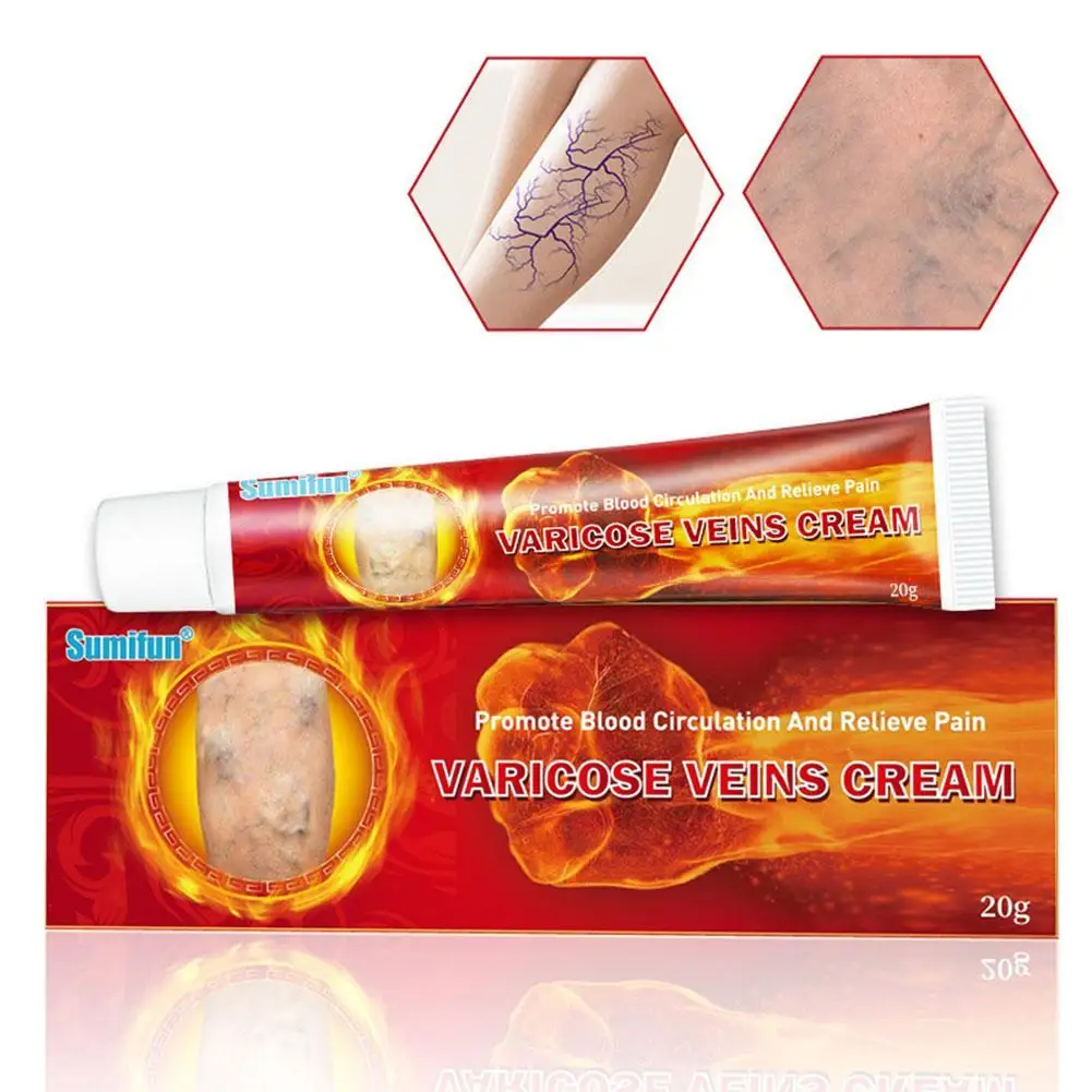 

Effective Herbal Varicose Veins Relief Cream Vasculitis Phlebitis Spider Pain Relief Ointment Herb Plaster Beauty Body Care 20g