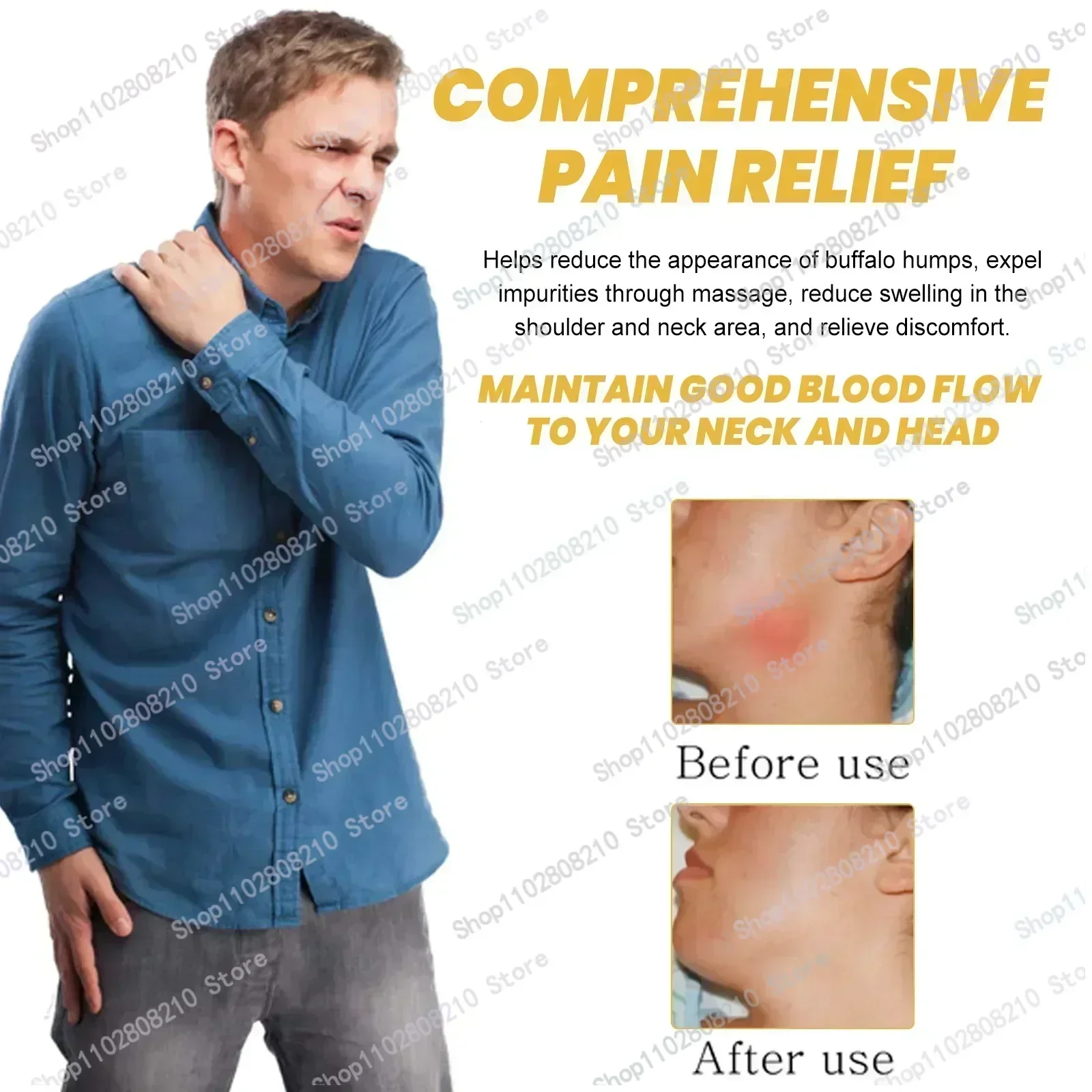 ГОРЯЧИЙ ~ Удаление губ облегчение боли против тунковой отек отеки кожи