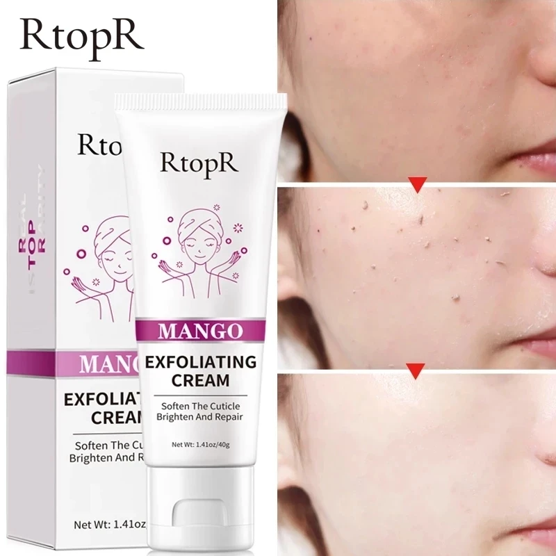 

40g Face Exfoliating Cream Whitening Moisturizer Repair Facial Scrub Cleaner Remove Acne Blackhead Treatment Skin Care Cream