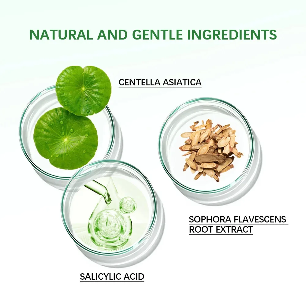 Рисунок 6 - Эффективное средство для лечения акне