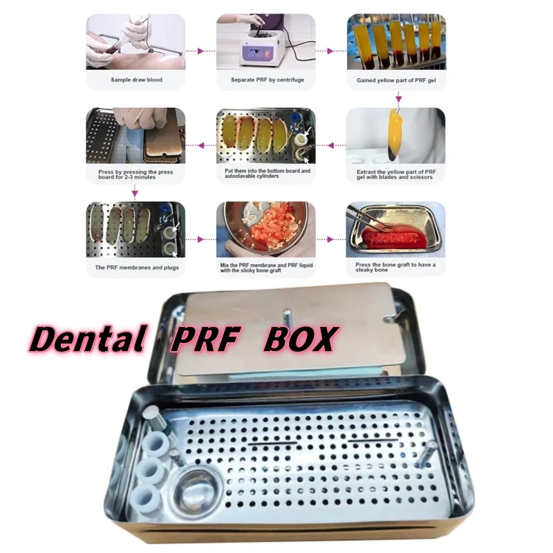 1 комплект PRF Box Platelet Rich Fibrin Case Стоматологический Тарлетная мембрана давления