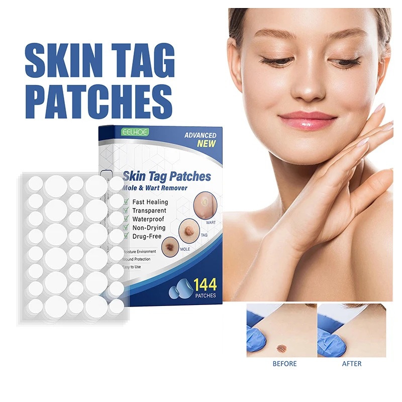 

144pcs Skin Tag Remover Patches Invisible Mole Wart Removing Sticker Natural Ingredients Corn Patch Wart Mole Skin Care Tools