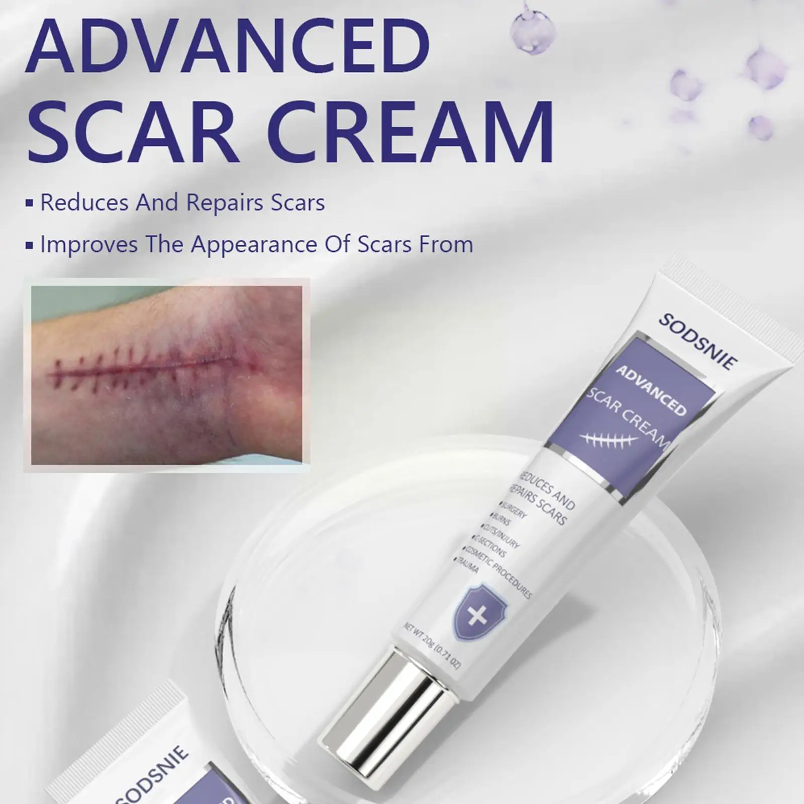 Улучшенный крем для шрамов, ежедневное бритье, хирургический увлажняющий, гладкое лечение, растягивание, отбеливание, восстановление шрамов, питательный знак R3N0