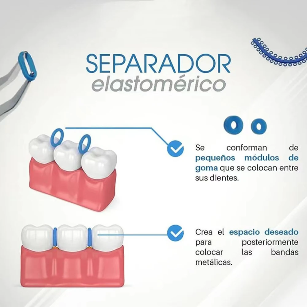Стоматологический ортодонтический сепаратор пружинный синий круг 10 шт.