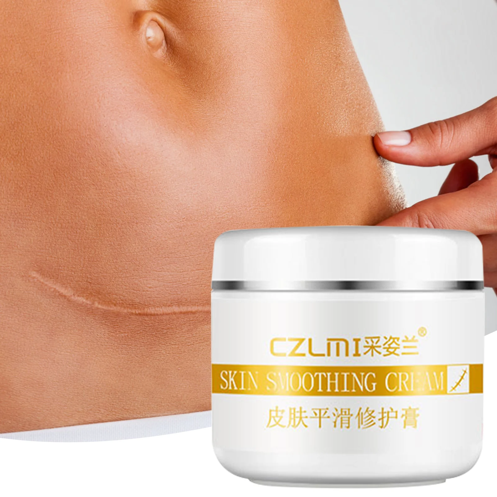 

Removal Scar Cream Face Pimples Scar Stretch Marks Removal Acne Treatment Whitening Moisturizing Cream Skin Care 30g