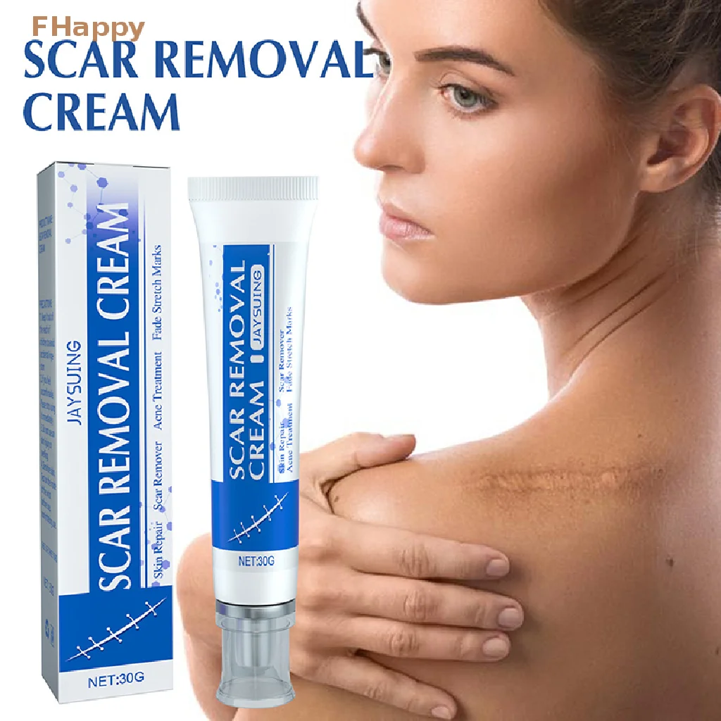 

30g Scar Removing Cream Stretch Mark Removal Gel Face Body Acne Marks Injury Cesarean Burn Abrasions Scars Skin Repair Ointment