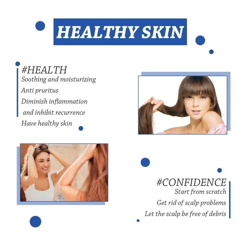 Sdotter Новый Seborrheic крем для кожи на голову против акне тинеи зуда