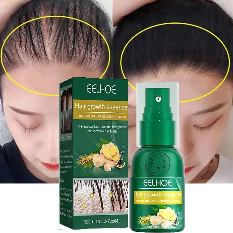 

Сыворотка Имбирная для роста волос, против выпадения волос, 30 мл