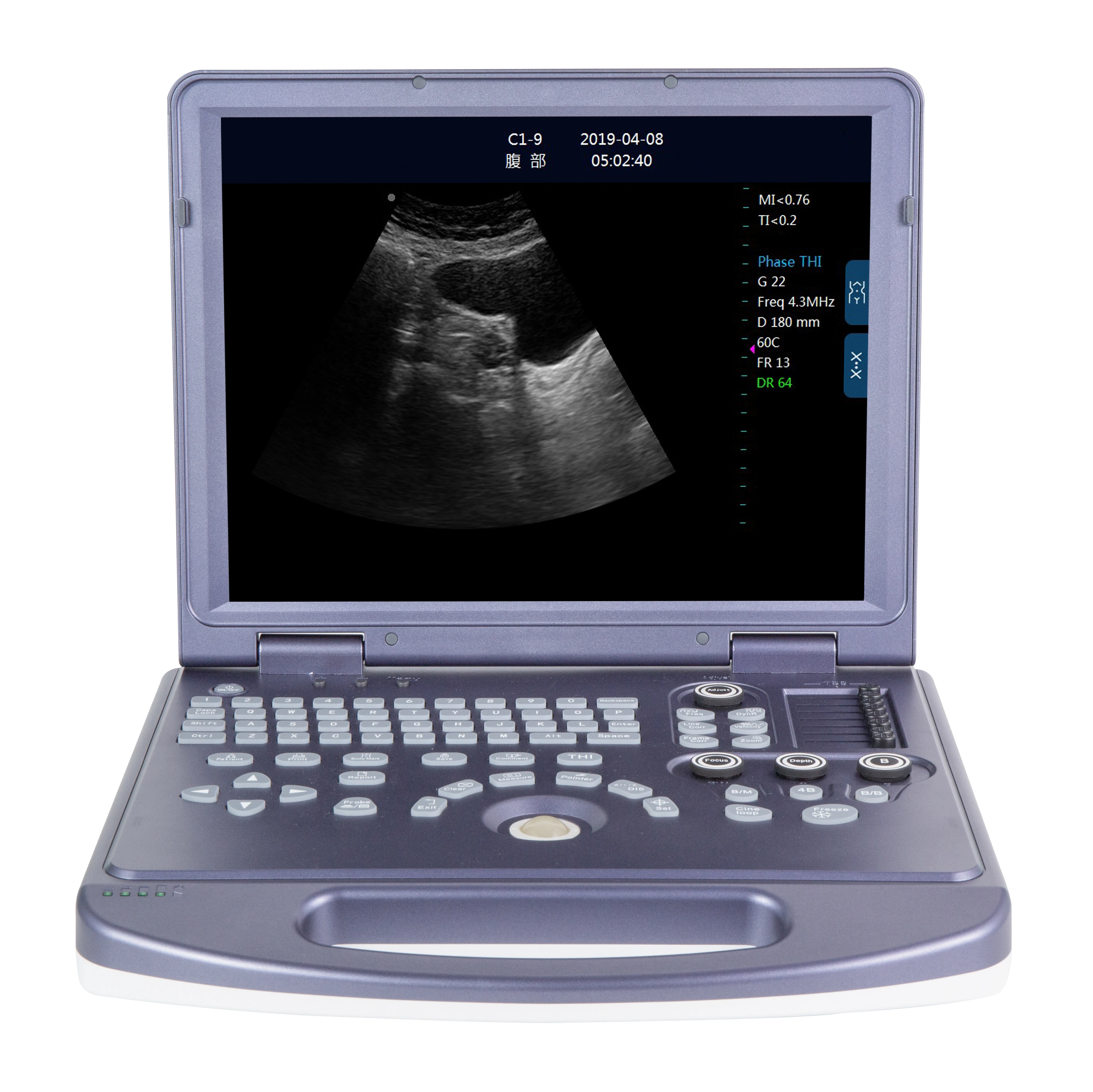 

RC-BW360 2d portable cardiac ultrasound machine price pa kistan