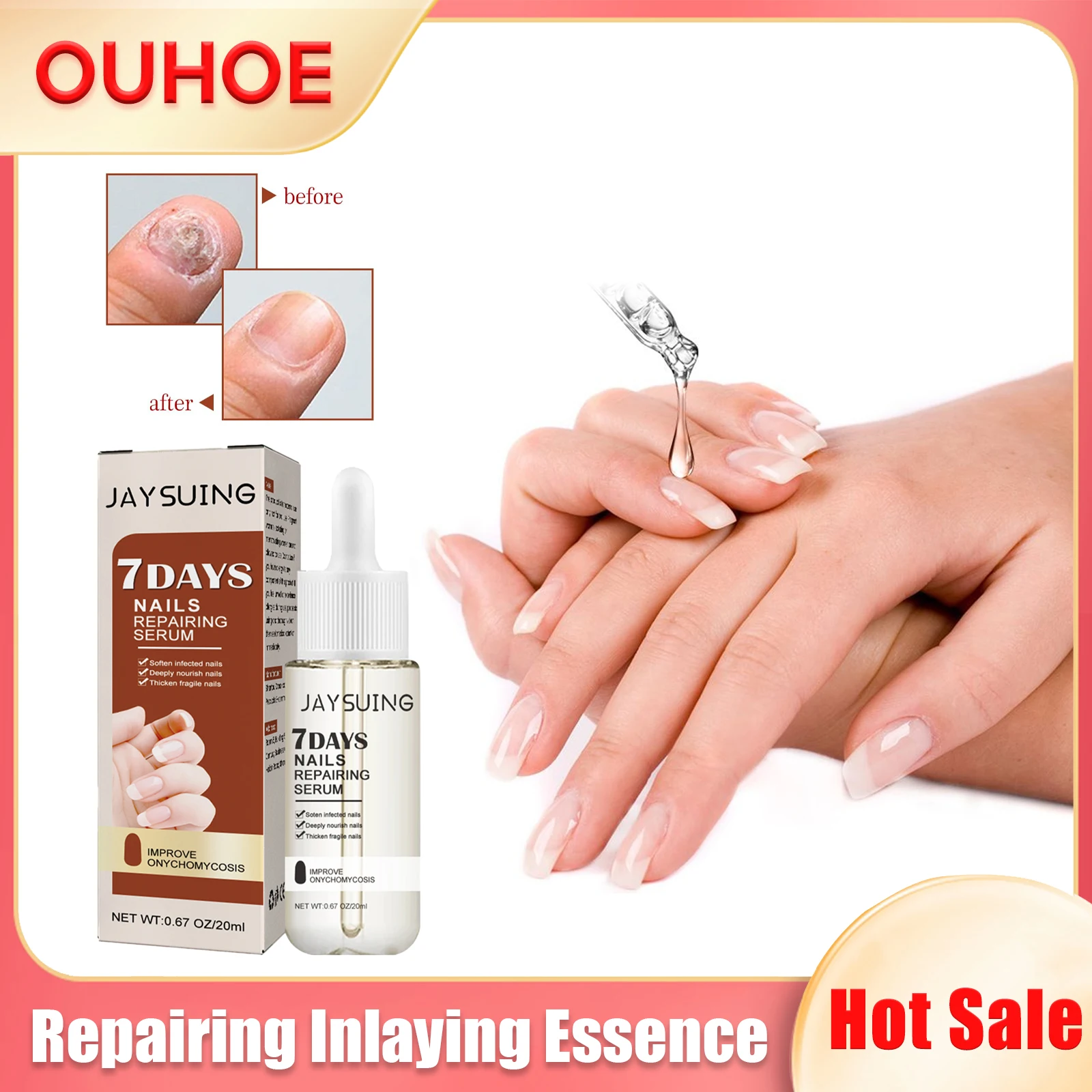 

Nail Repair Essence Soften Damaged Fungal Nails Anti-Infection Onychomycosis Paronychia Treatment Toe Nail Fungus Removal Serum