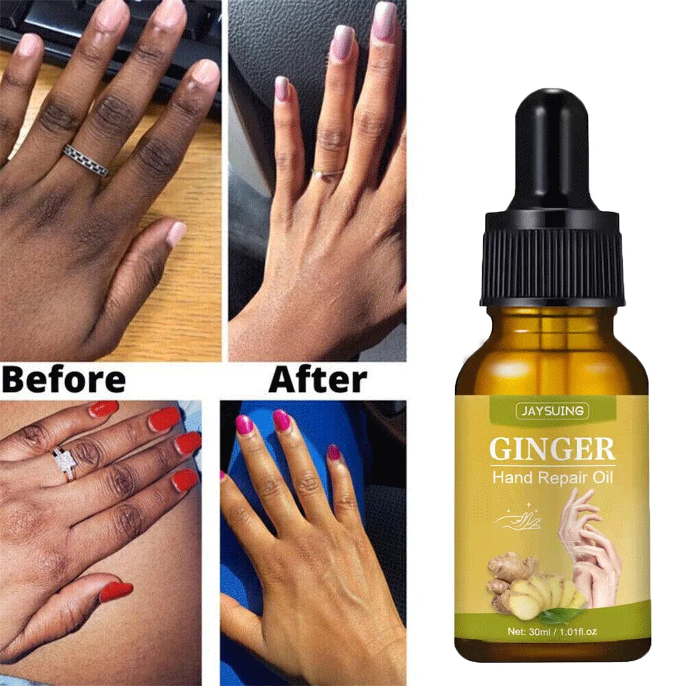 Hand Serum Ginger Hand Essence Oil Anti-Dry Moisturizing Whitening Brighten Anti-Aging Anti-Wrinkle Fades Fine Lines Hand Skin