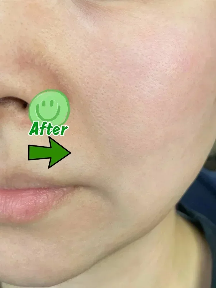 Мужской крем для восстановления отверстий против прыщей устраняющий отверстие