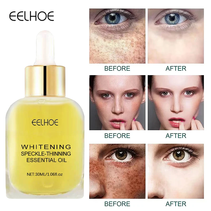 

Whitening Freckle Face Serum Remover Dark Spots Lighten Melanin Melasma Anti-aging Essence Moisturizing Nourishing Care Products