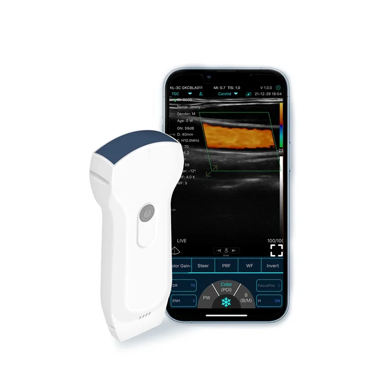 

Cost-effective Double Probes Wireless Doppler Ultrasound Scanner Ultrasound Probe Handheld Device