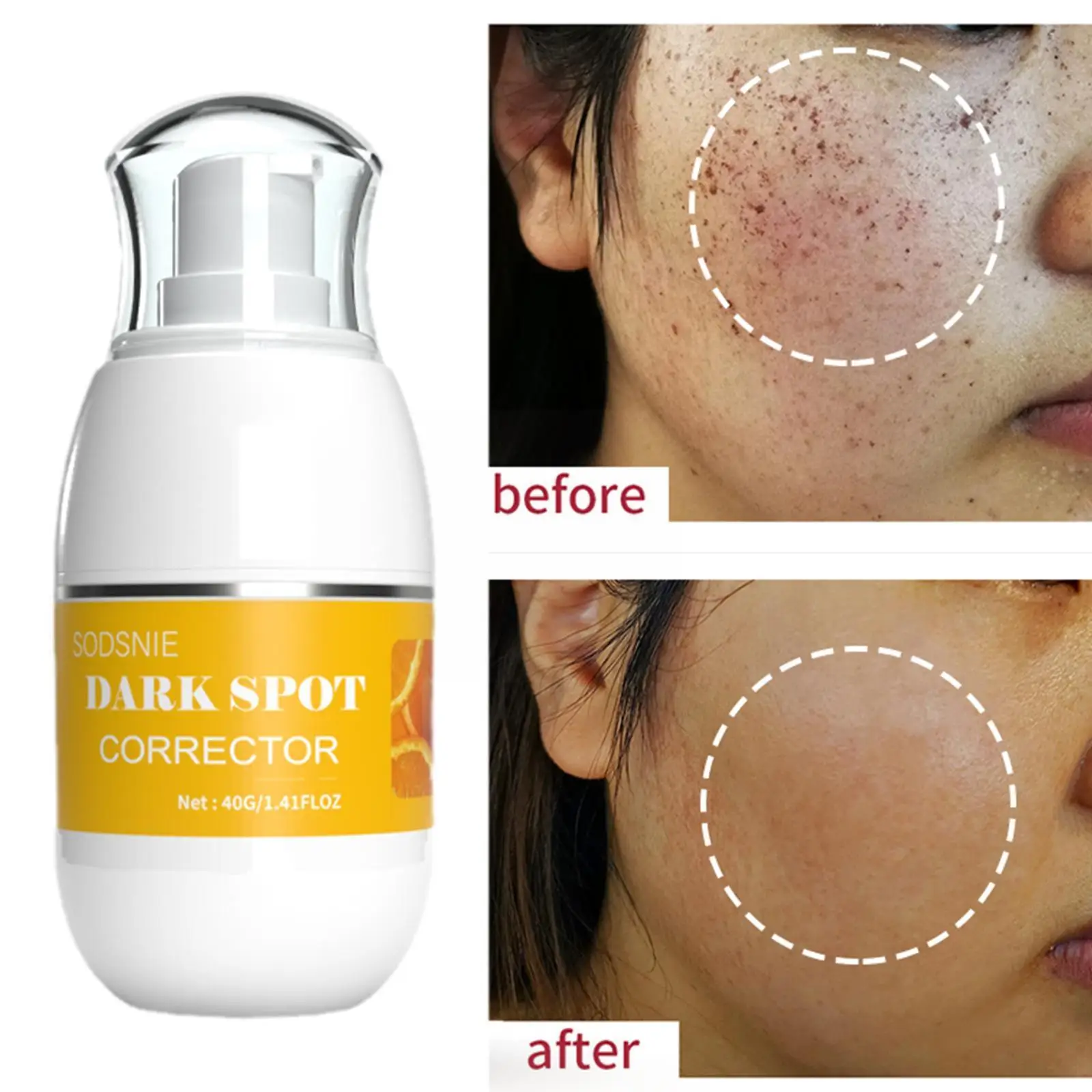 

Dark Spot Corrector Moisturizing Effectively Removes Spots 40G Brightening Dark Skin Care Spots Spots Age Whitening Sun Chl Y3C5