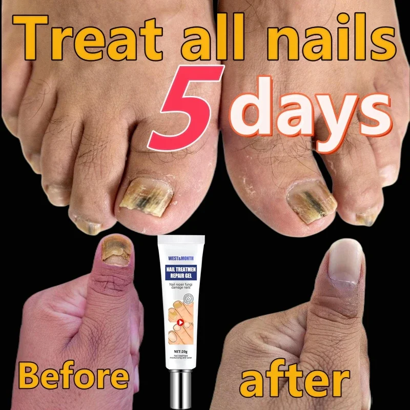 

toe nails cuticle remover cuticle oil nail strengthener nails