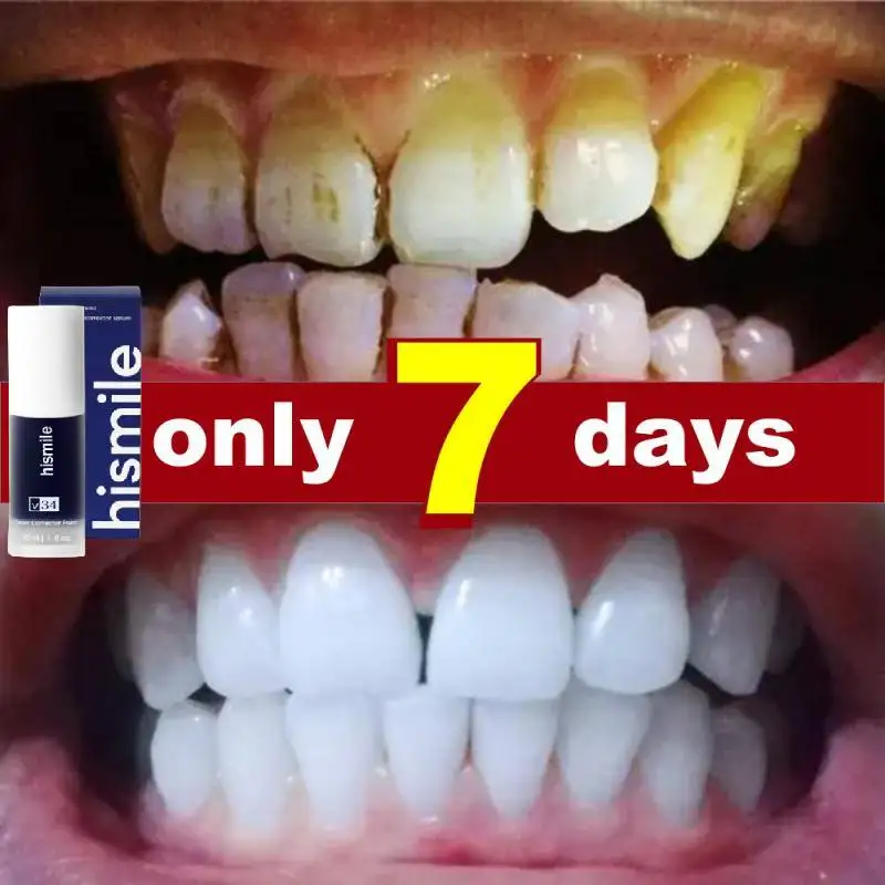 

30ml HISMILE V34 Purple Toothpaste Colour Corrector Teeth For Teeth Whitening Brightening Reduce Yellowing Cleaning Tooth Care